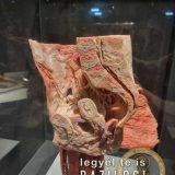 Szent Bazil Középiskola Body Worlds, ahol az anatómia óra ’életre’ kel! Hírek Nyíregyházi Tagintézmény Szent Bazil Középiskola Body Worlds, ahol az anatómia óra ’életre’ kel! Hírek Nyíregyházi Tagintézmény