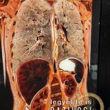 Szent Bazil Középiskola Body Worlds, ahol az anatómia óra ’életre’ kel! Hírek Nyíregyházi Tagintézmény Szent Bazil Középiskola Body Worlds, ahol az anatómia óra ’életre’ kel! Hírek Nyíregyházi Tagintézmény